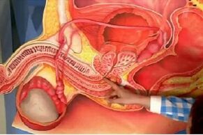 Masaxe de próstata para aumentar o espesor do pene